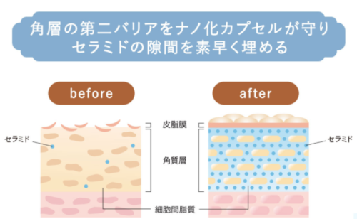 タイムレスウォータークレンジングは、角層育成ナノカプセルで第二バリアとなる細胞間脂質を新生させる効果が期待できる